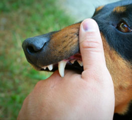 Dog Bites